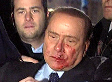 Italian PM Hospitalised After Attack