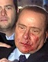 Italian PM Hospitalised After Attack