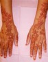 Chemicals in Henna Cause Allergies