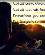 Wounds Heal (Scars Don't)