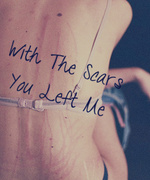 With The Scars You Left Me